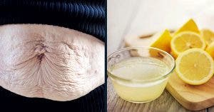 Une ancienne au citron qui efface les vergetures et vous offre une peau liftée et jolie