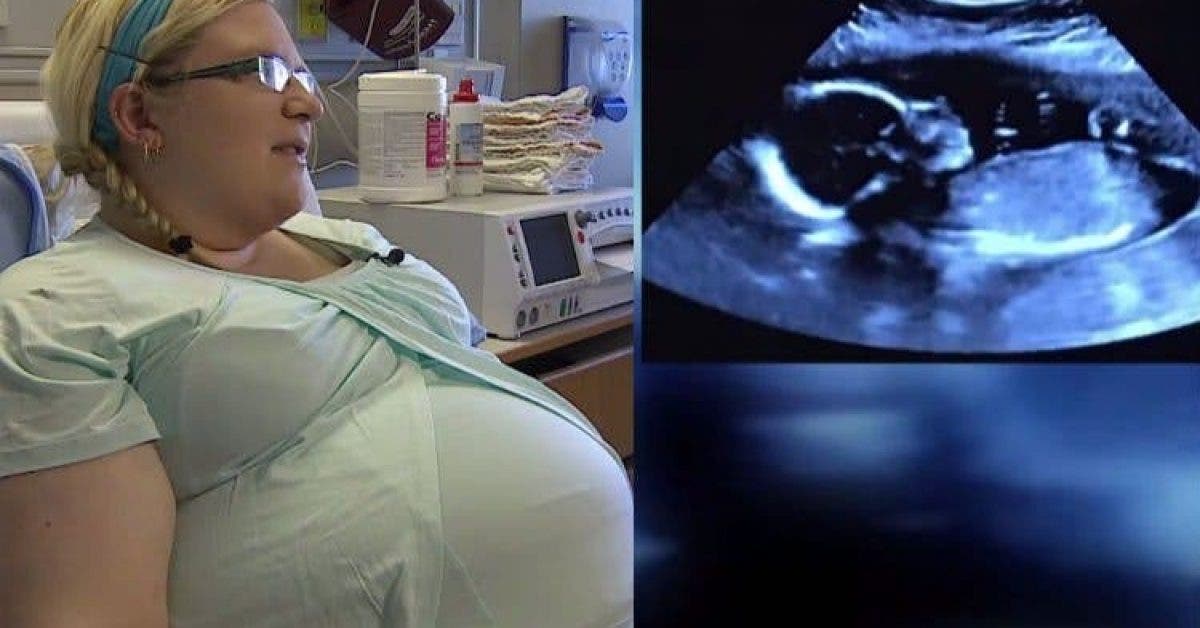 Une femme donne naissance à des quadruplés et les médecins sont abasourdis quand ils voient leurs visages