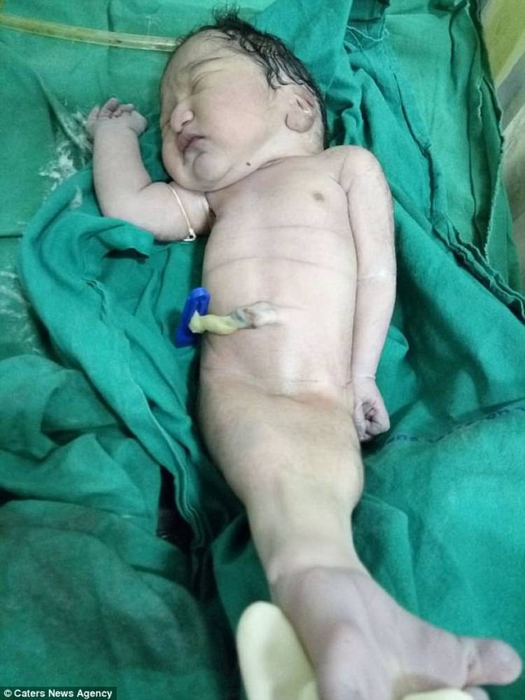 Une femme donne naissance à un bébé sirène