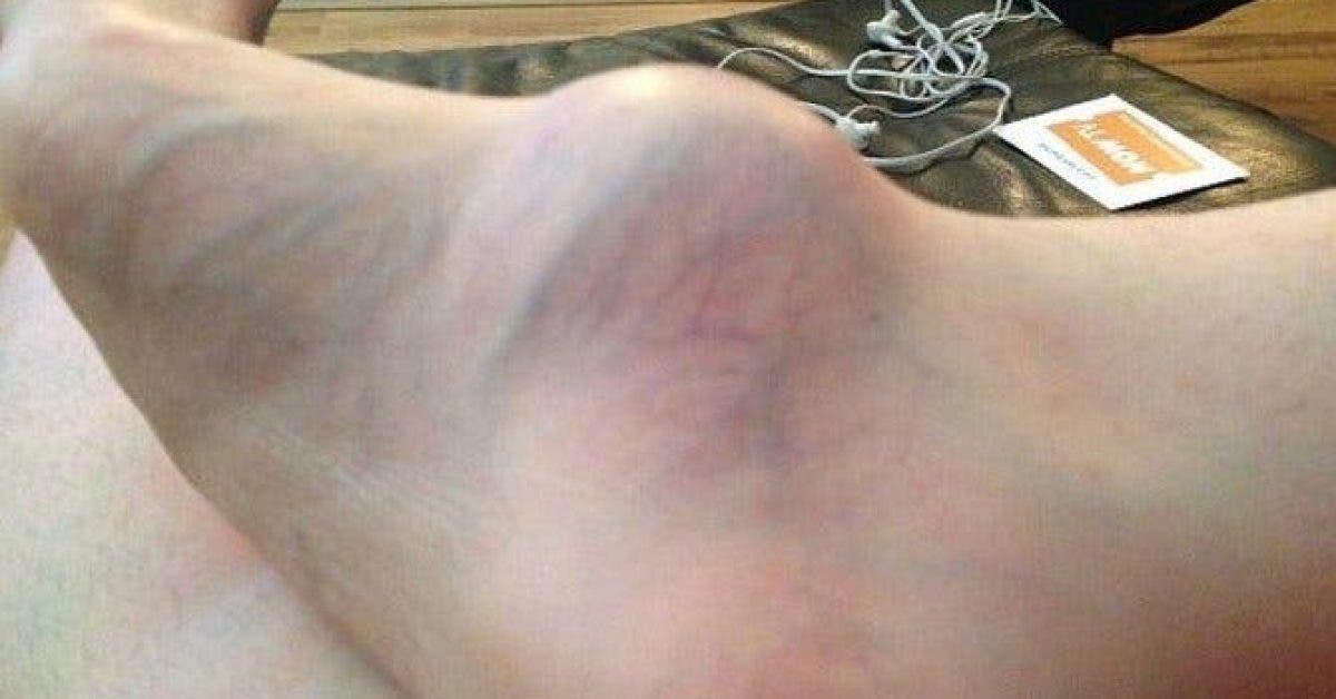 Une femme rend visite à un médecin pour discuter de son pied enflé