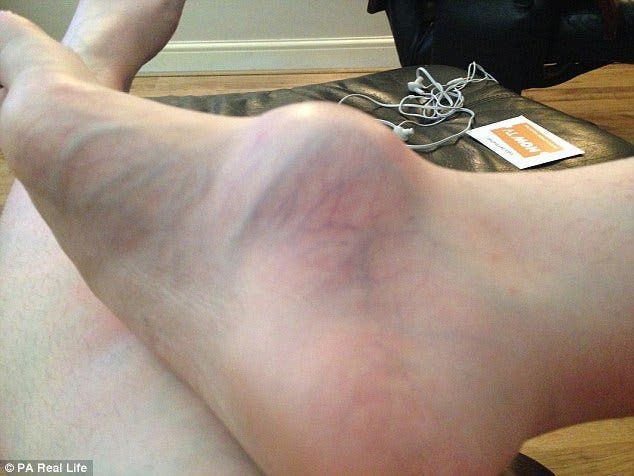 Une femme déchire un médecin pour discuter de son pied enflé