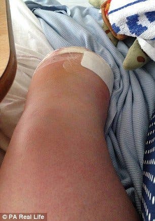 Une femme déchire un médecin pour discuter de son pied enflé