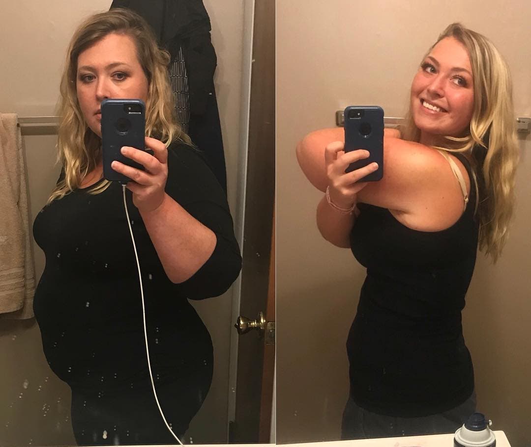Une femme réussit à perdre 54 kg grâce au régime cétogène
