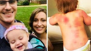 Une maman découvre 25 marques de morsures sur sa fille