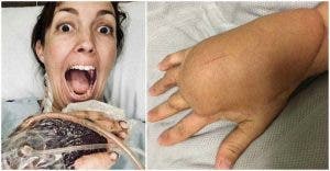 Une maman se bat pour sa vie après avoir blessé son doigt