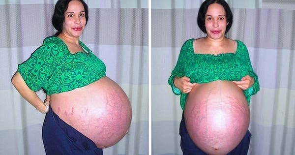 La grossesse de cette mère célibataire a suscité beaucoup d’insultes et de critiques mais huit ans plus tard, tout est différent.
