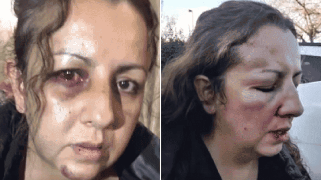 Une mère est violentée après avoir affronté le harceleur de sa fille
