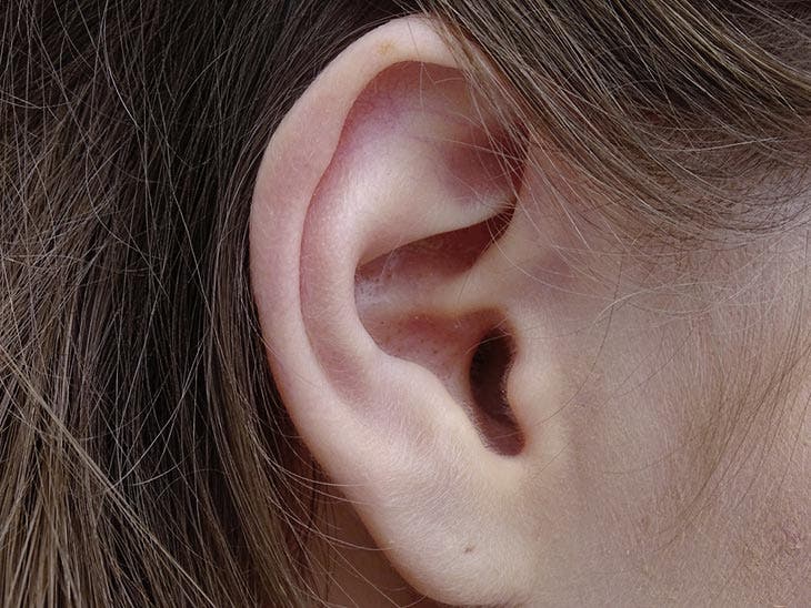Un orecchio senza seni preauricolari