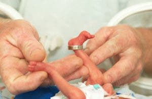 Une petit bébé de 680 grammes né et se bat pour vivre