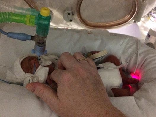 Une petit bébé de 680 grammes né et se bat pour vivre