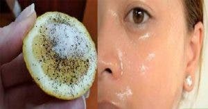 Une recette au citron pour effacer les taches du visage et avoir une peau éclatante