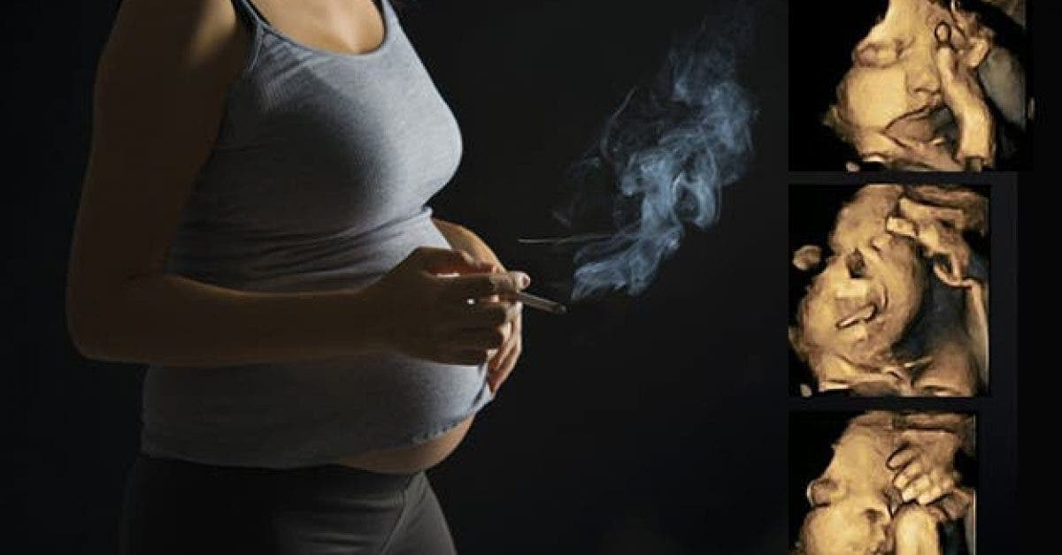 Voici à quoi ressemblent les échographies des fumeuses enceintes