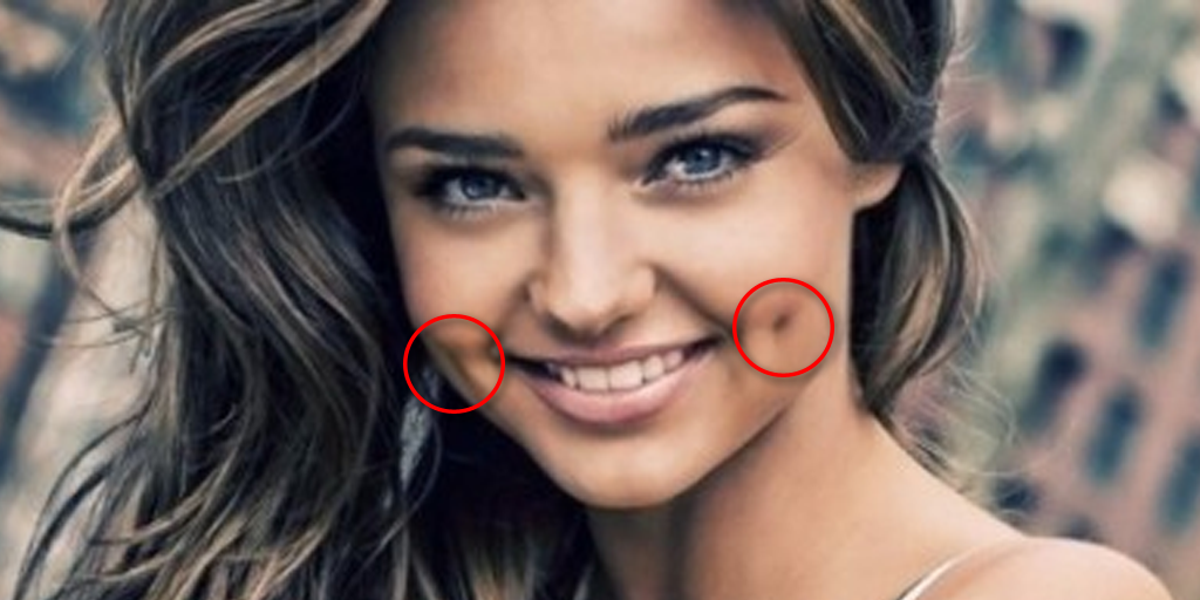 La Signification Des Fossettes Sur Les Joues