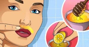 Voici comment éliminer les poils du visage chez vous à la maison avec des astuces naturelles2