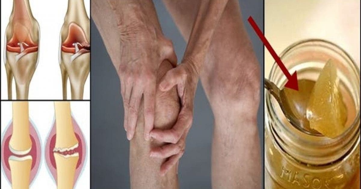 Voici comment régénérer le cartilage du genou naturellement
