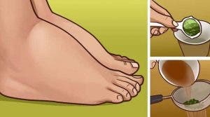 Voici comment soigner vos chevilles et pieds enflés naturellement. Ca marche !
