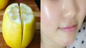 Voici comment utiliser le citron pour enlever les taches de votre visage et avoir une peau de bébé