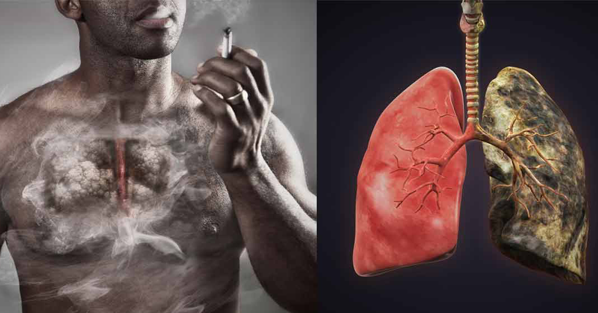 Voici la différence entre des poumons sains et ceux d’un fumeur