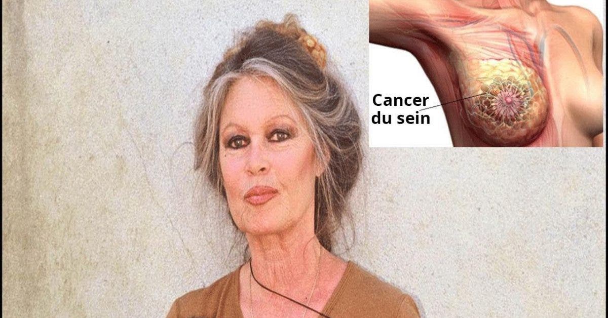 Voici pourquoi Brigitte Bardot a refusé la chimiothérapie pour traiter son cancer