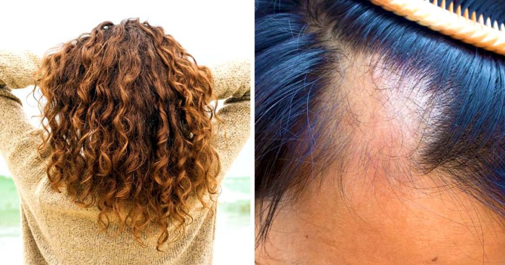 4 astuces naturelles pour couvrir les cheveux blancs sans coloration