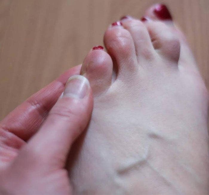 Vos pieds révèlent beaucoup de choses sur votre personnalité