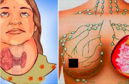 Warning: You have never thought that this drink is destroying your thyroid gland and much more ...