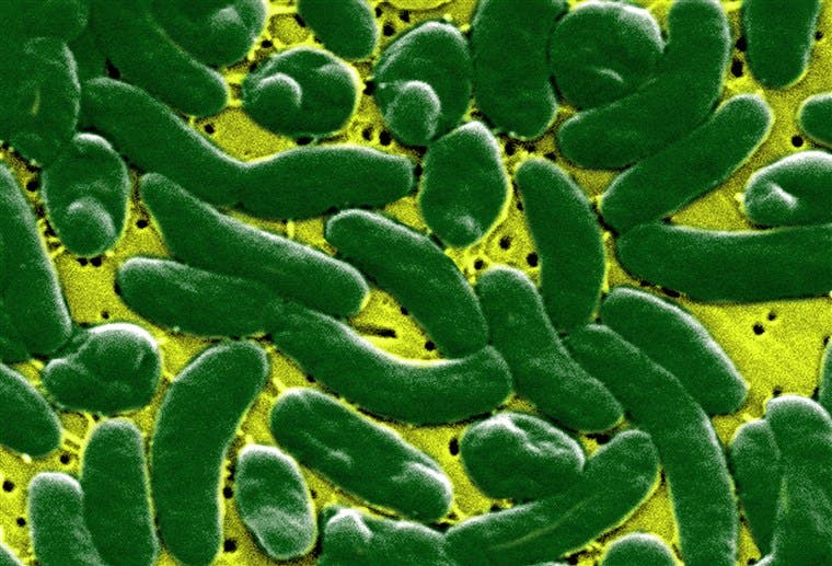 bacterie vibrio