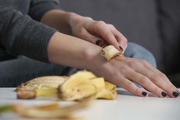 Calm skin irritations with banana peel