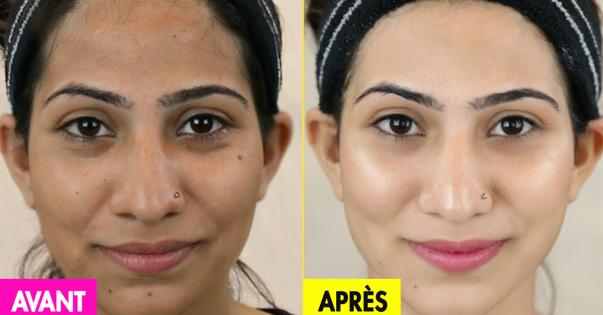 Comment Faire Pour Avoir Un Teint Clair Naturellement