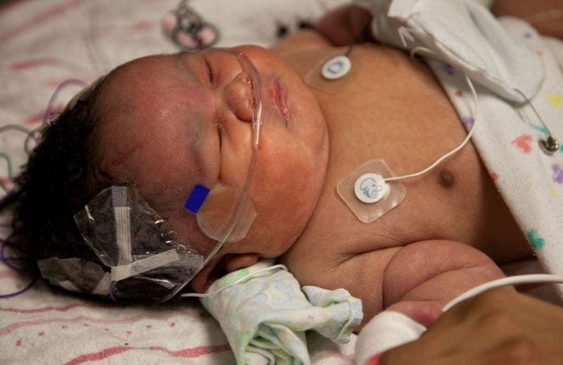 Déclaré mort, ce bébé revient à la vie après les prières de sa mère