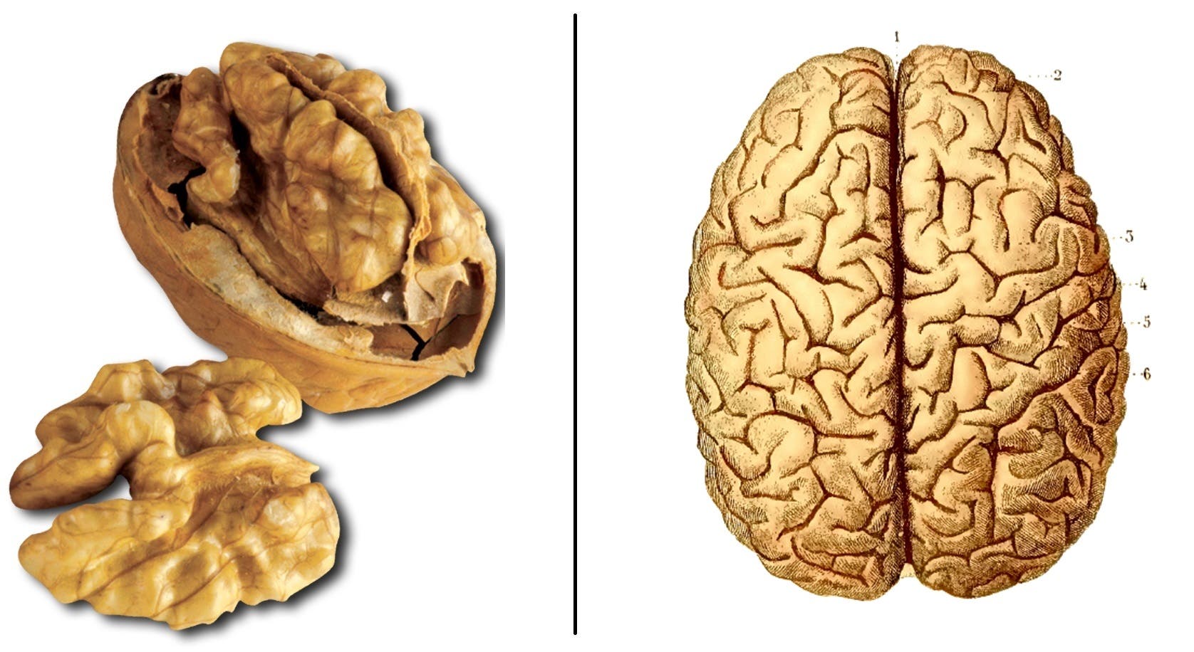 these foods-like-to-heal-they-nut-brain-organ