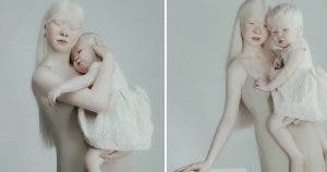 ces-soeurs-albinos-nees-a-12-ans-dintervalle-eblouissent-le-monde-par-leur-beaute-unique