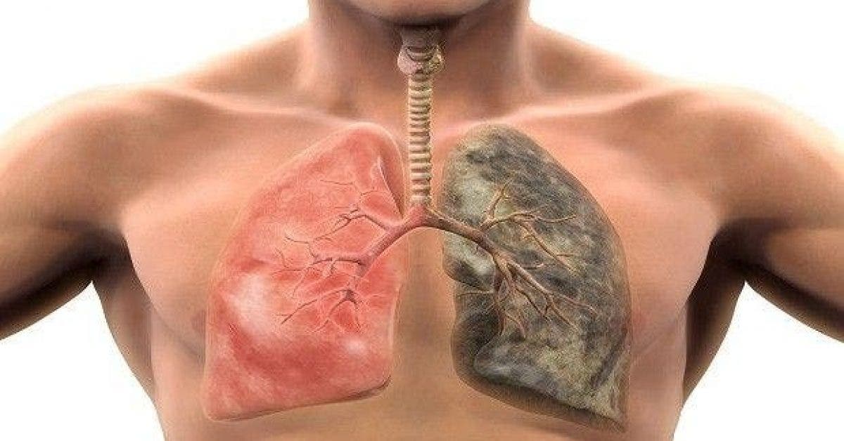 comment guerir votre poumon facilement et rapidement 1