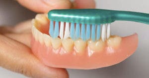 Comment prendre soin de votre prothèse dentaire pour prolonger sa durée de vie ?