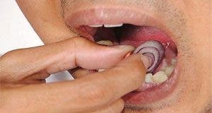 comment soulager les maux de dents et les infections dentaires naturellement 1