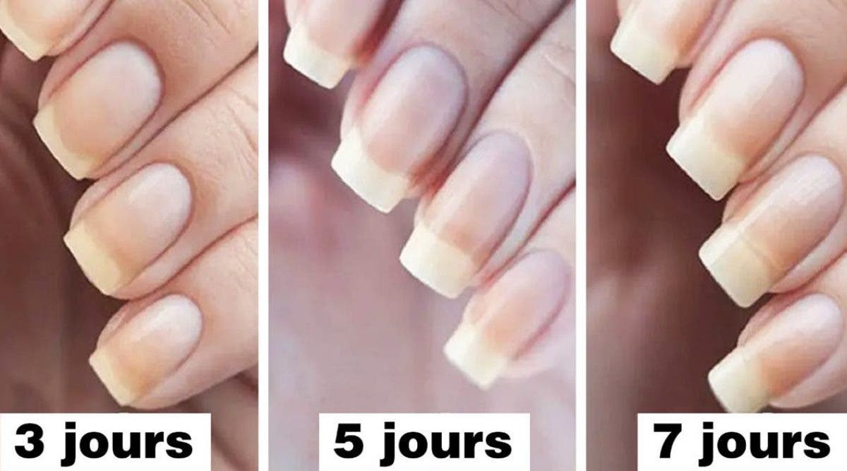 comment-utiliser-du-bicarbonate-de-soude-pour-avoir-des-ongles-plus-longs-et-plus-forts