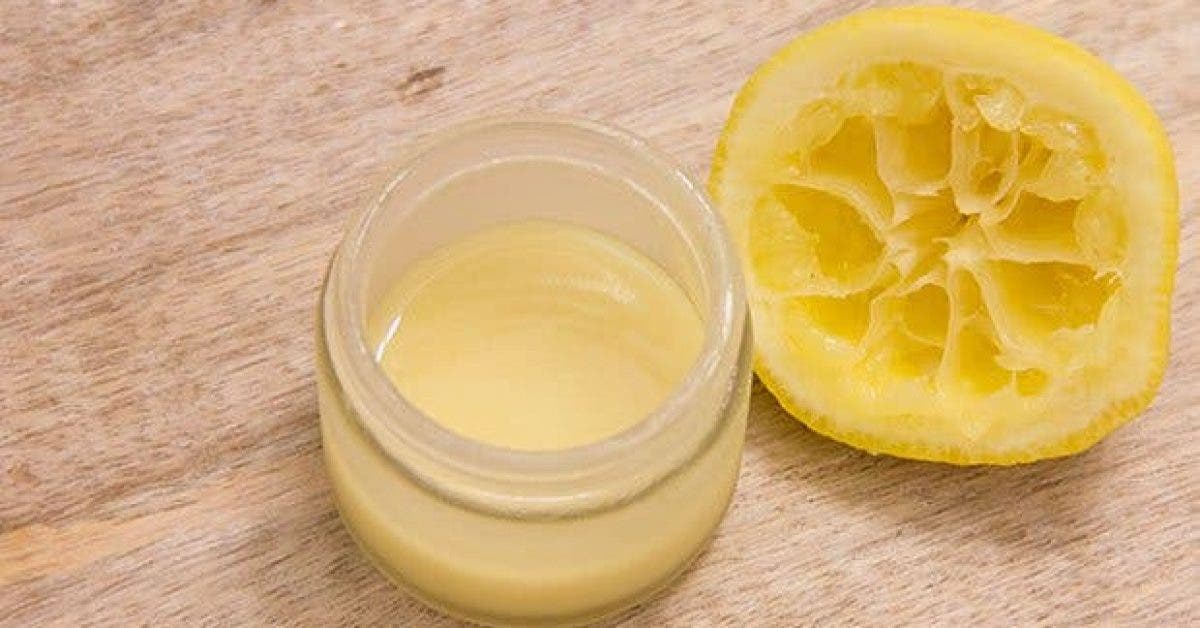 comment utiliser le miel et le citron pour eliminer les traces dacne2