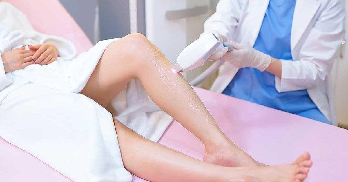 Découvrez l'épilation laser : une méthode efficace et sûre