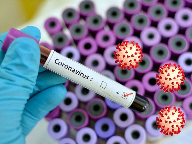depistage coronavirus