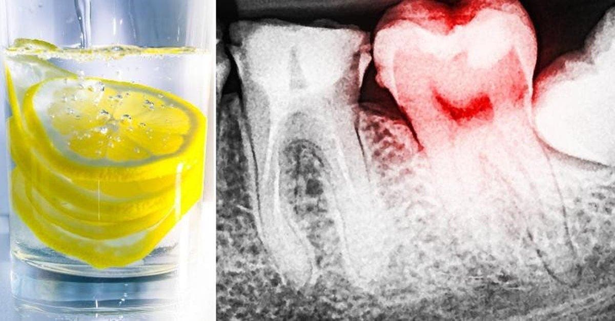 L’eau au citron peut détruire vos dents