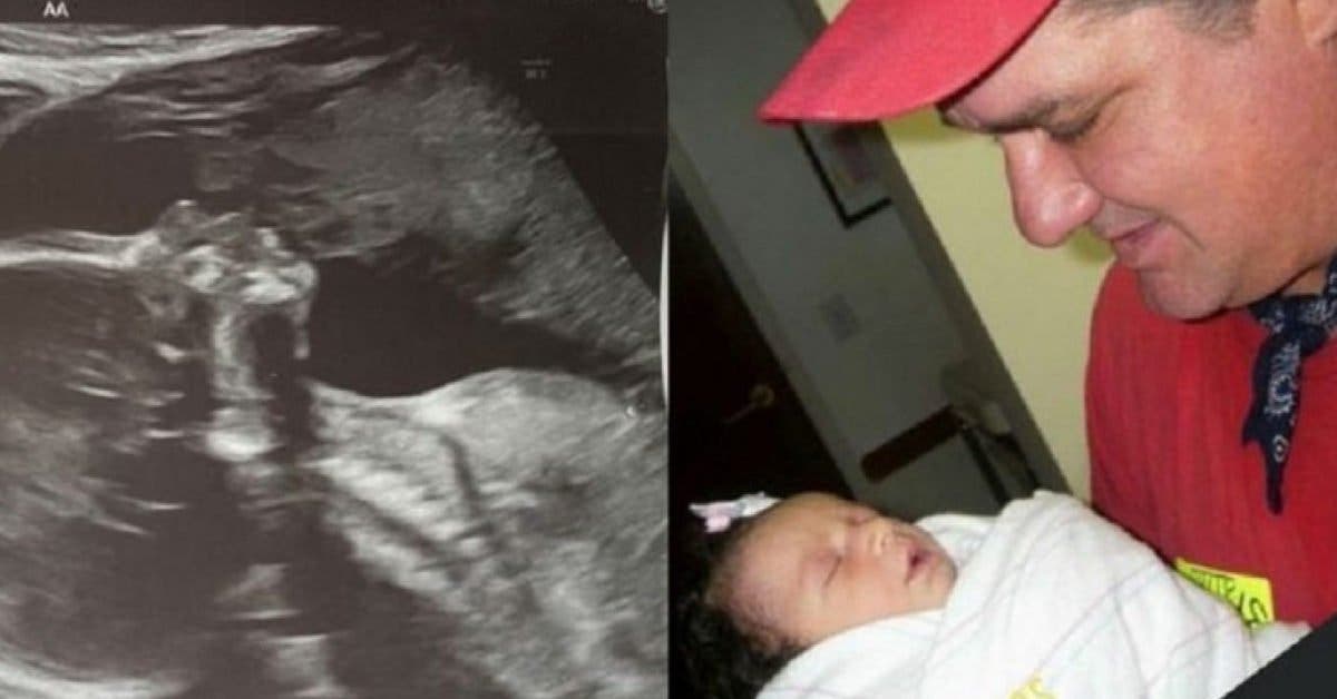 Cette femme enceinte voit le "père décédé" embrasser sa fille dans l'échographie - L'image devient virale sur les réseaux sociaux