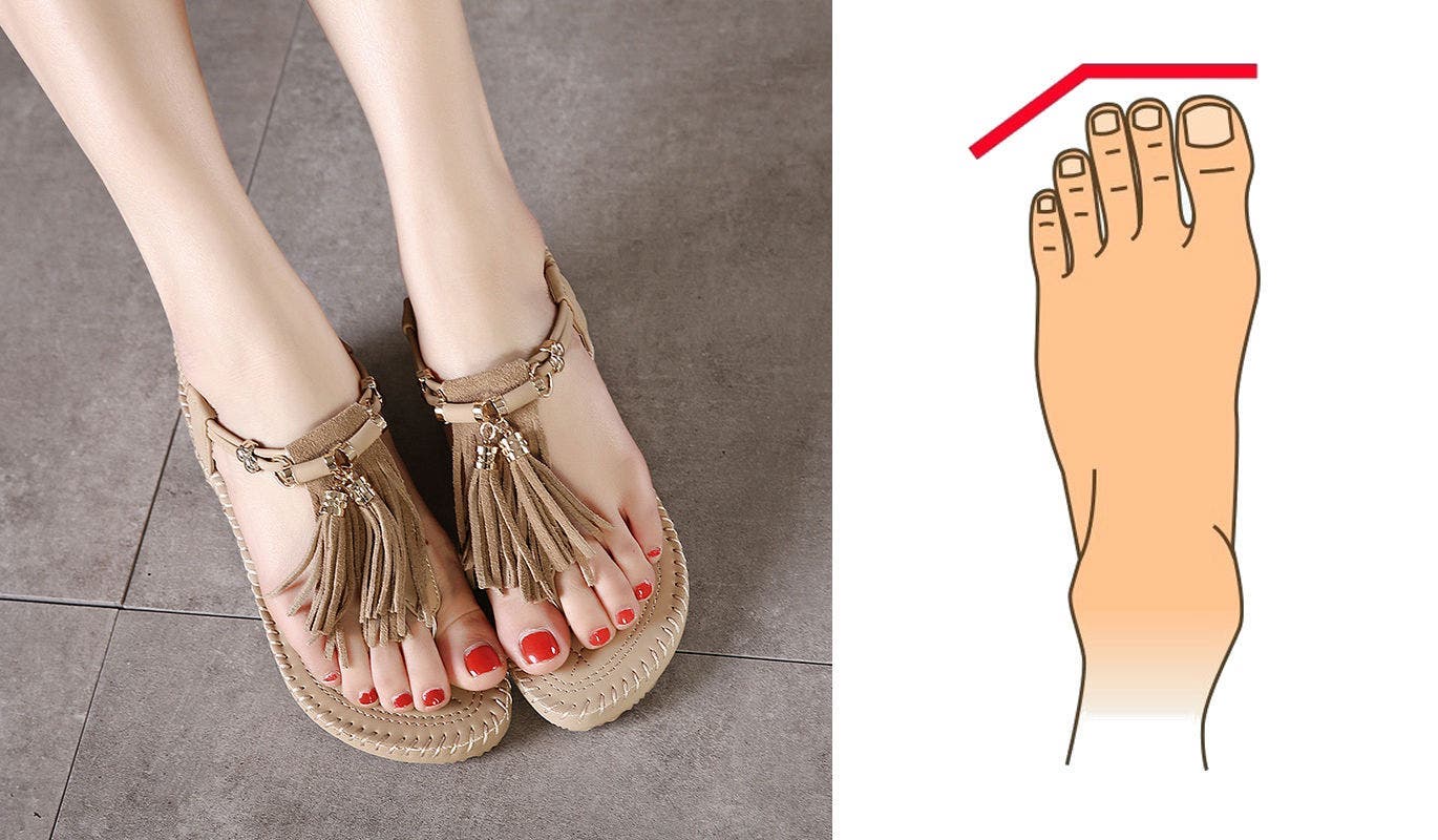 Какие бывают пальцы ног. Греческая форма стопы. Формы пальцев стоп. Греческие пальцы на ногах. Римская и Греческая стопа.