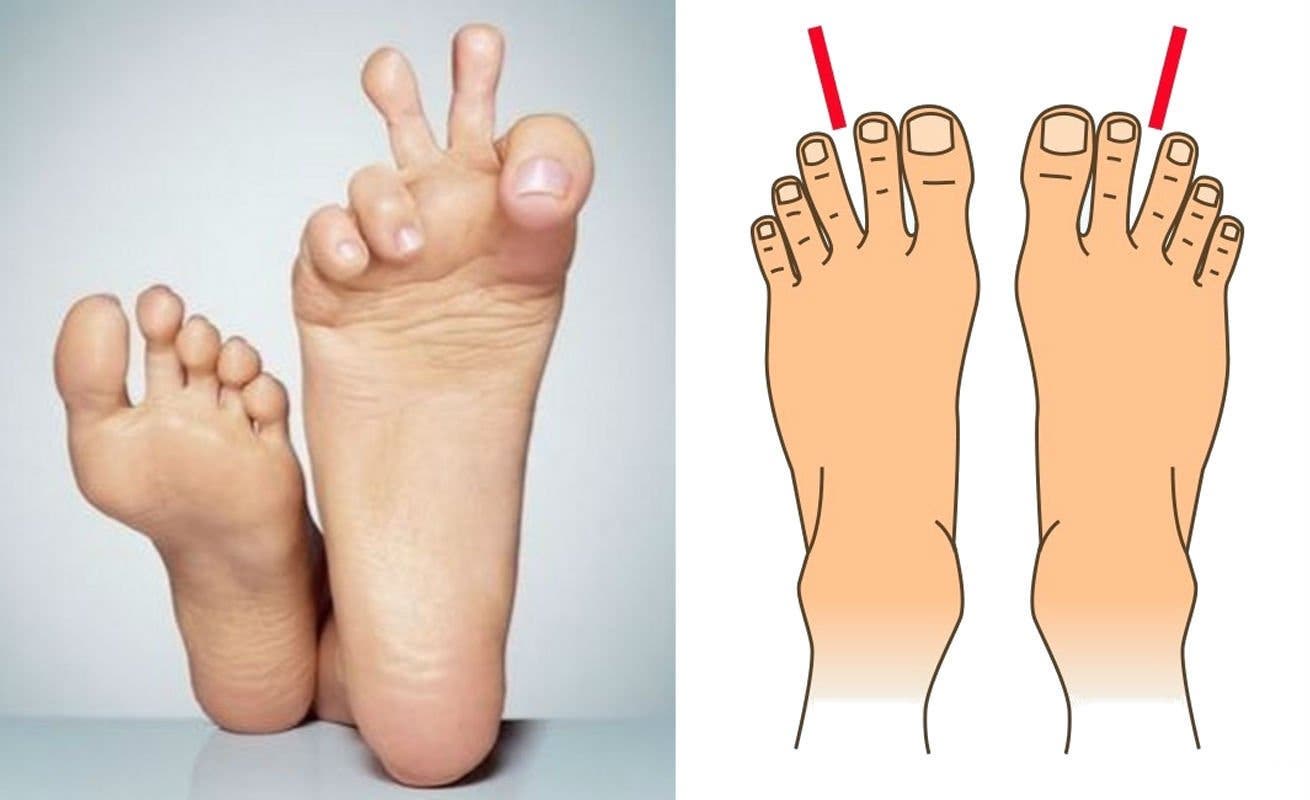 foot shapes