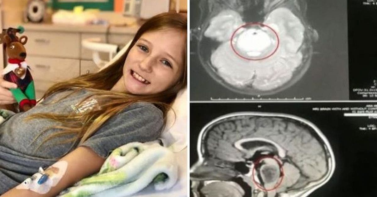 la-tumeur-cerebrale-dune-fillette-de-11-ans-disparait-miraculeusement-ses-parents-affirment-que-dieu-la-guerie