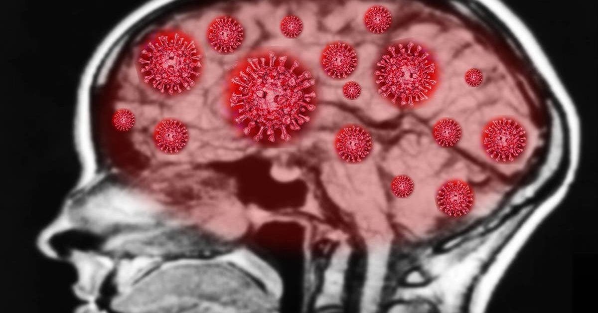 le-coronavirus-pourrait-declencher-une-vague-de-lesions-cerebrales-selon-des-chercheurs