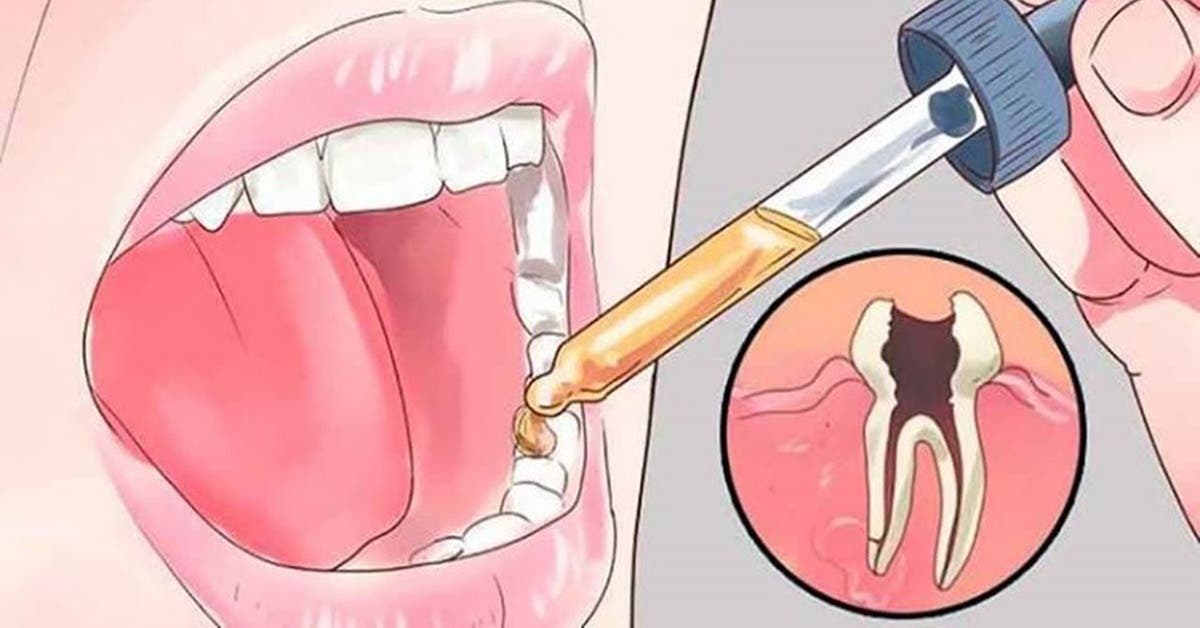 les 7 remedes naturels contre les maux de dents preferes des dentistes 1