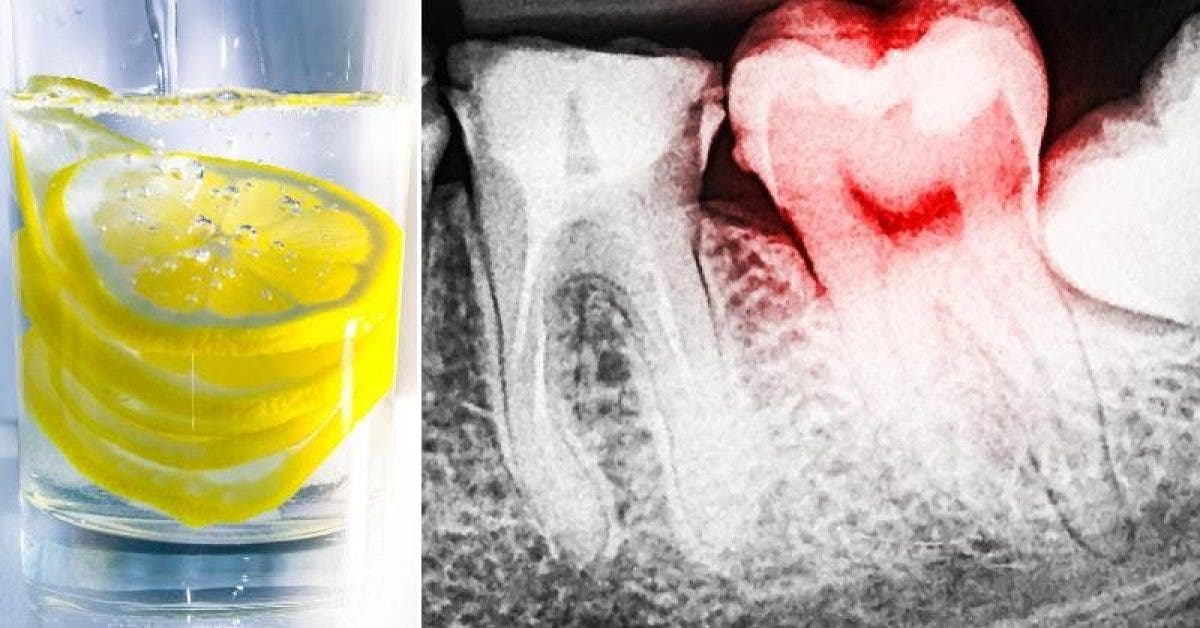 Les dentistes avertissent les gens qui aiment boire de l’eau au citron