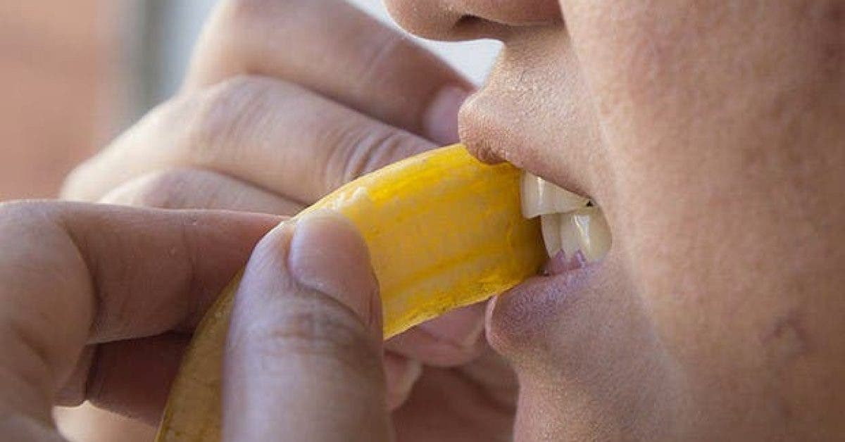 les meilleures techniques de blanchiment dentaire selon les medecins 1