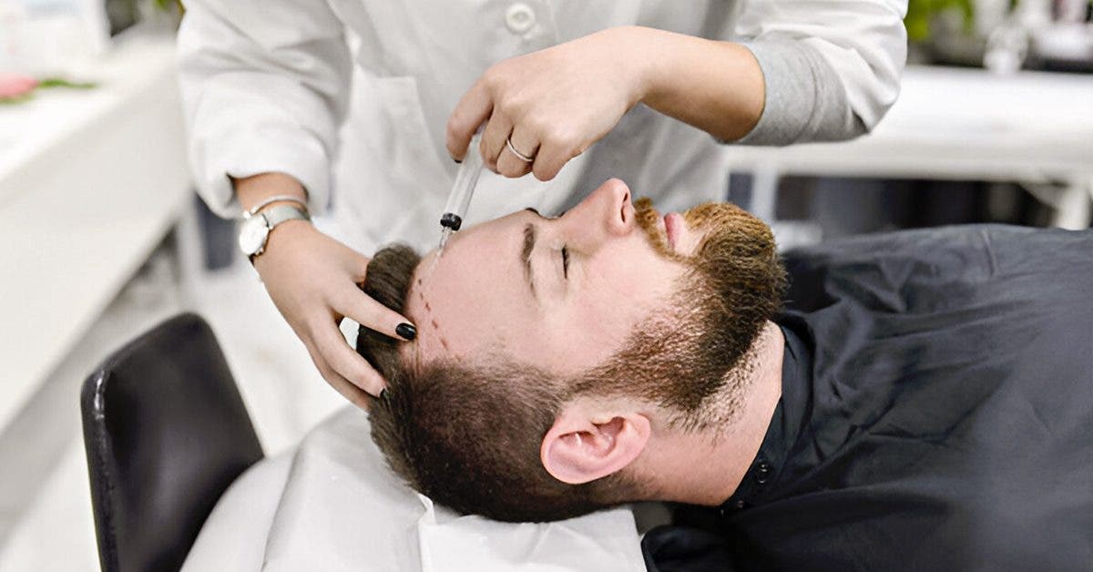 Mythes vs Réalité : ce que la greffe de cheveux peut vraiment offrir