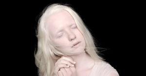 Naissance exceptionnelle en Argentine : des jumelles albinos éblouissent le monde